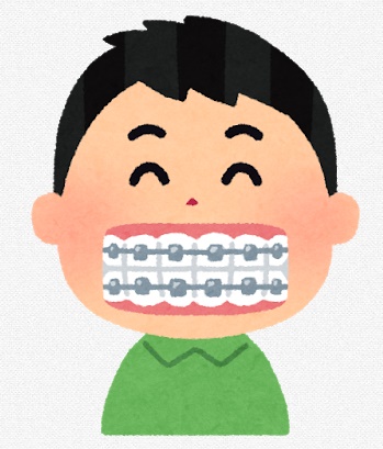 歯科矯正器具による口内炎が痛い