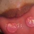 口内炎 パッチ 舌 歯茎 唇2